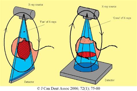 ct vs cbct|Cone beam computed tomography: basics and applications in .